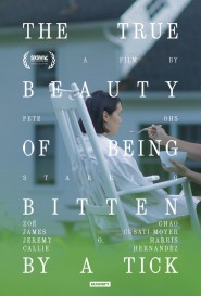 The True Beauty of Being Bitten by a Tick